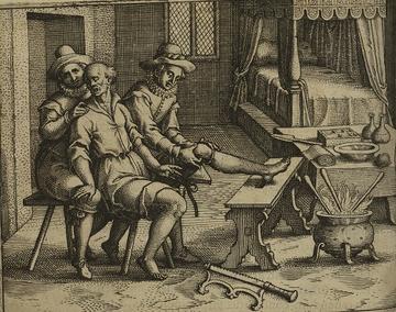 laerke gangrena et sphacelo